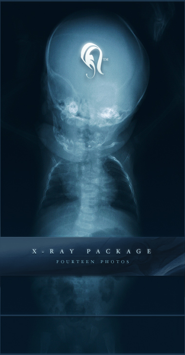 Package - X-ray - 1 - 